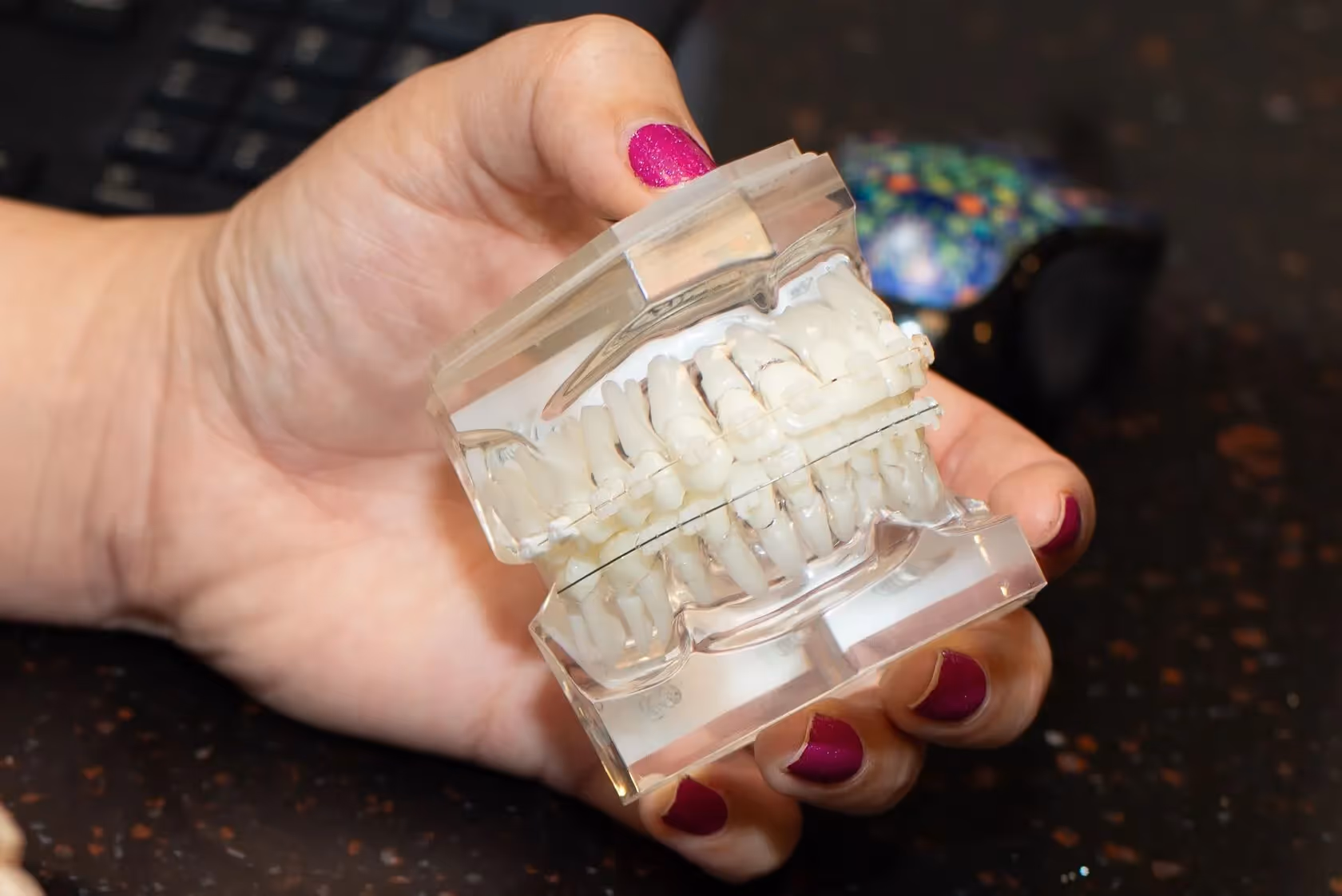 Lightforce: Custom 3D-Printed Brackets