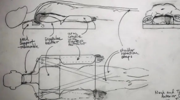 bonefoam process - invent 1