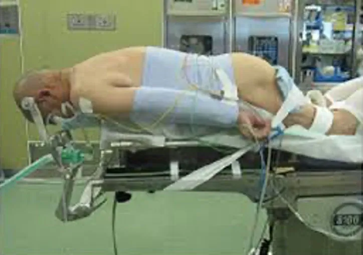 trauma problem state image