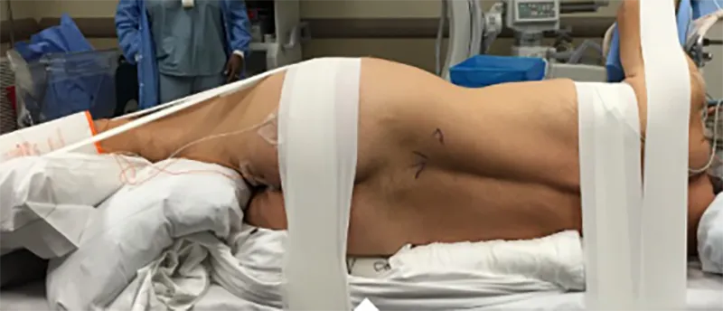 spine lumbar problem state