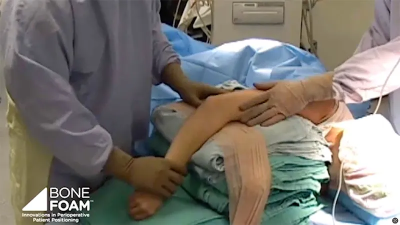 trauma upper extremity problem state