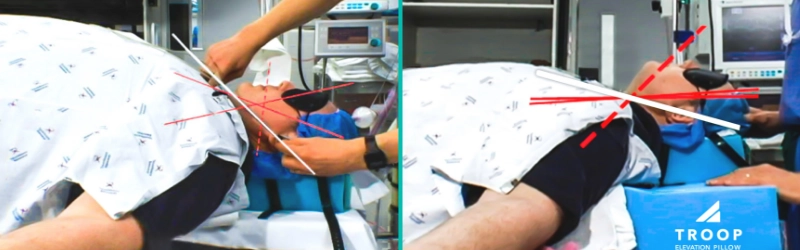 multipurpose anesthesia problem state