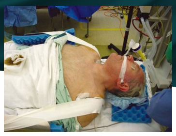 Anterior Cervical spine problem state