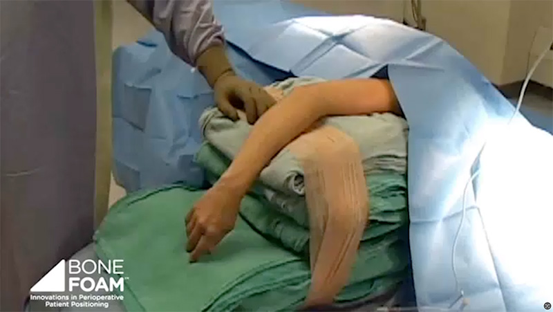 Upper Extremity problem state