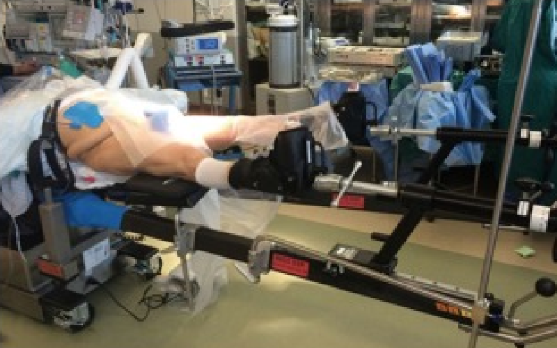 anterior hip surgery problem state