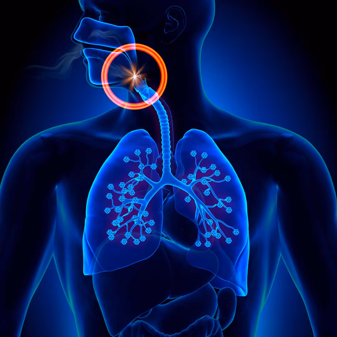 Sleep Apnea Treatment