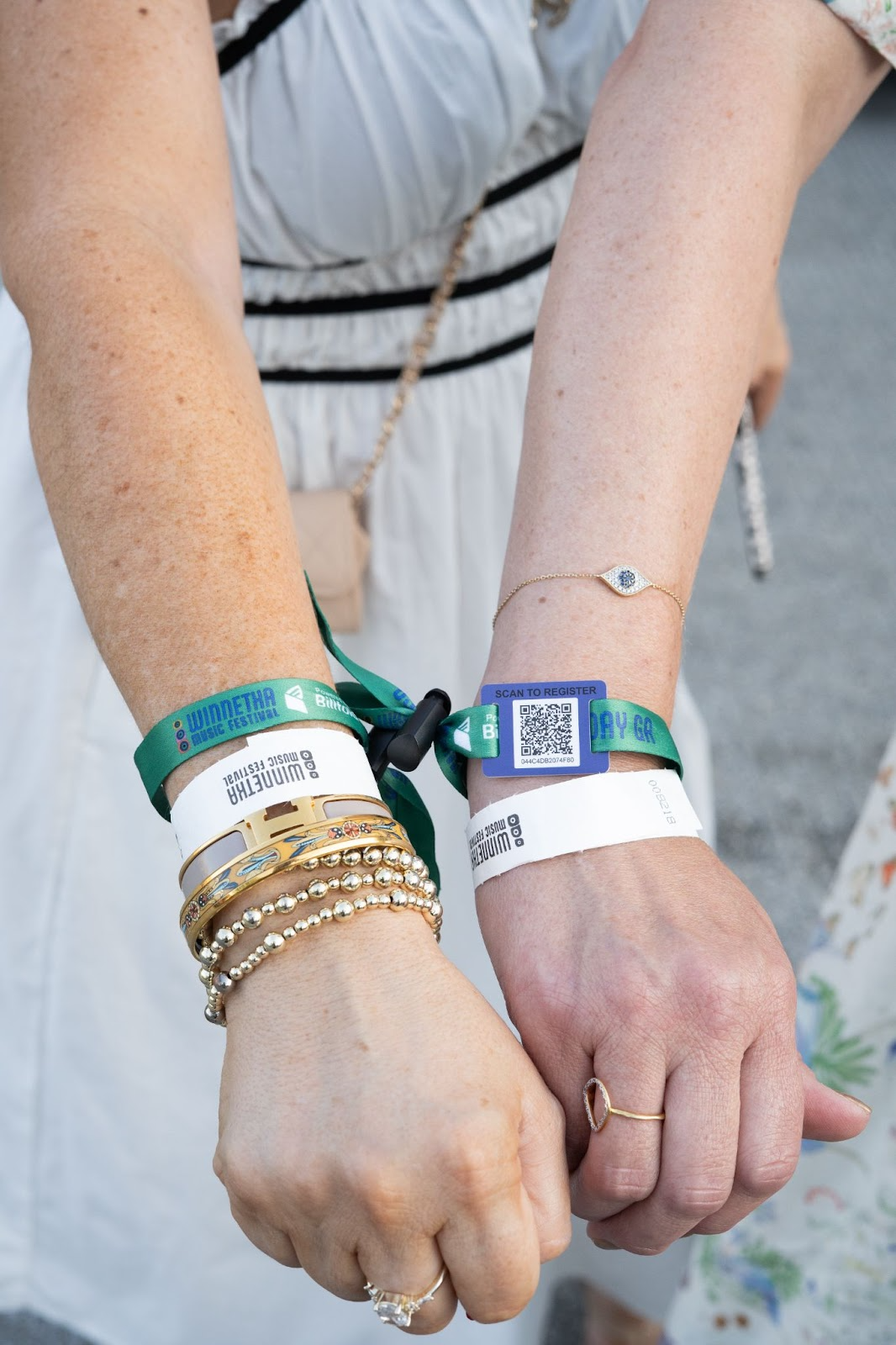 Close-up of RFID event wristbands showing cashless payment technology and festival access control systems