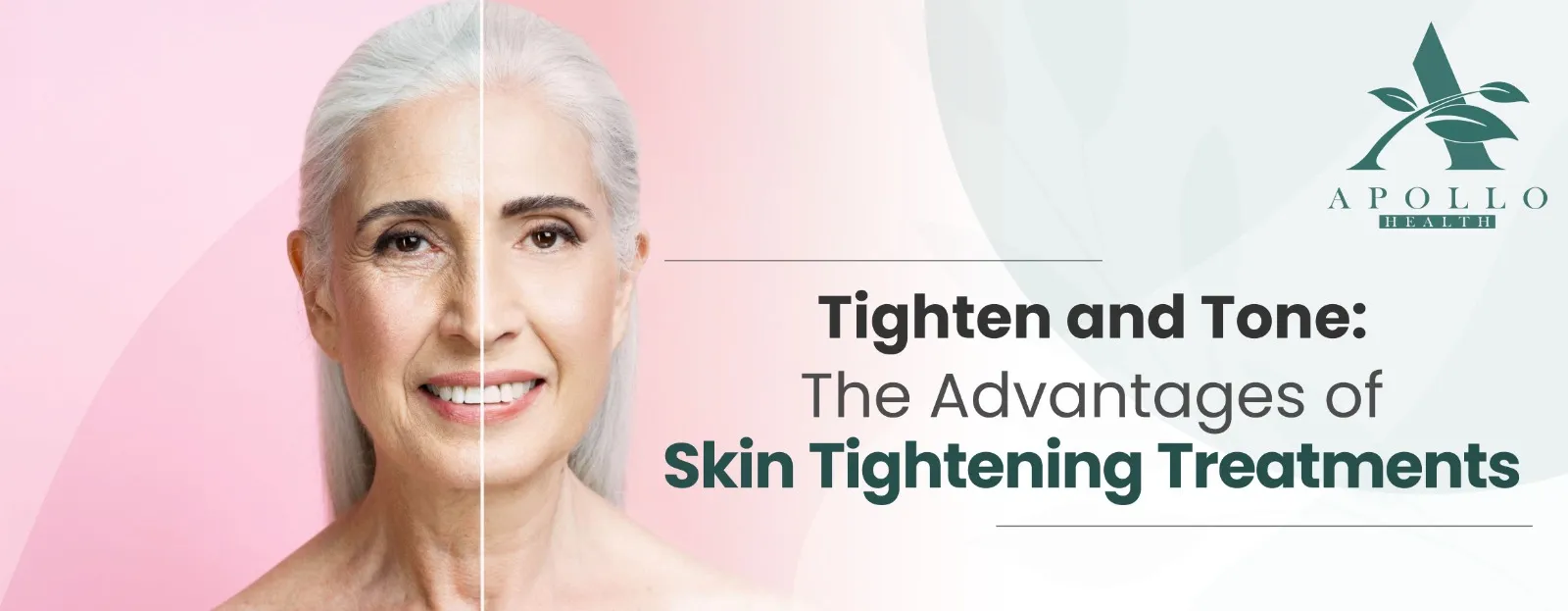 Tighten and Tone: The Advantages of Skin Tightening Treatments