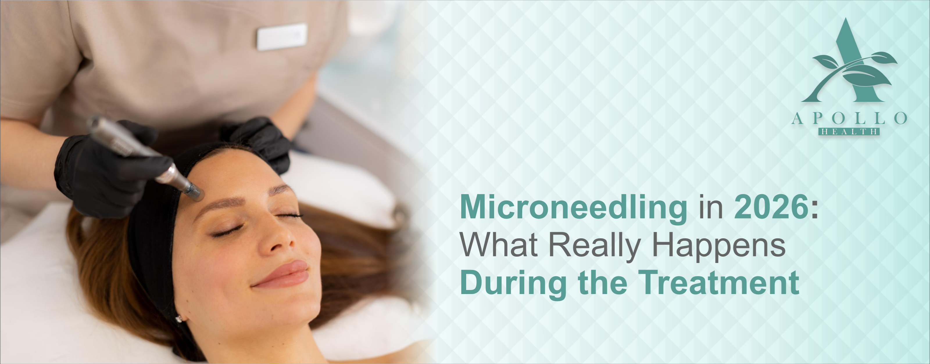Microneedling