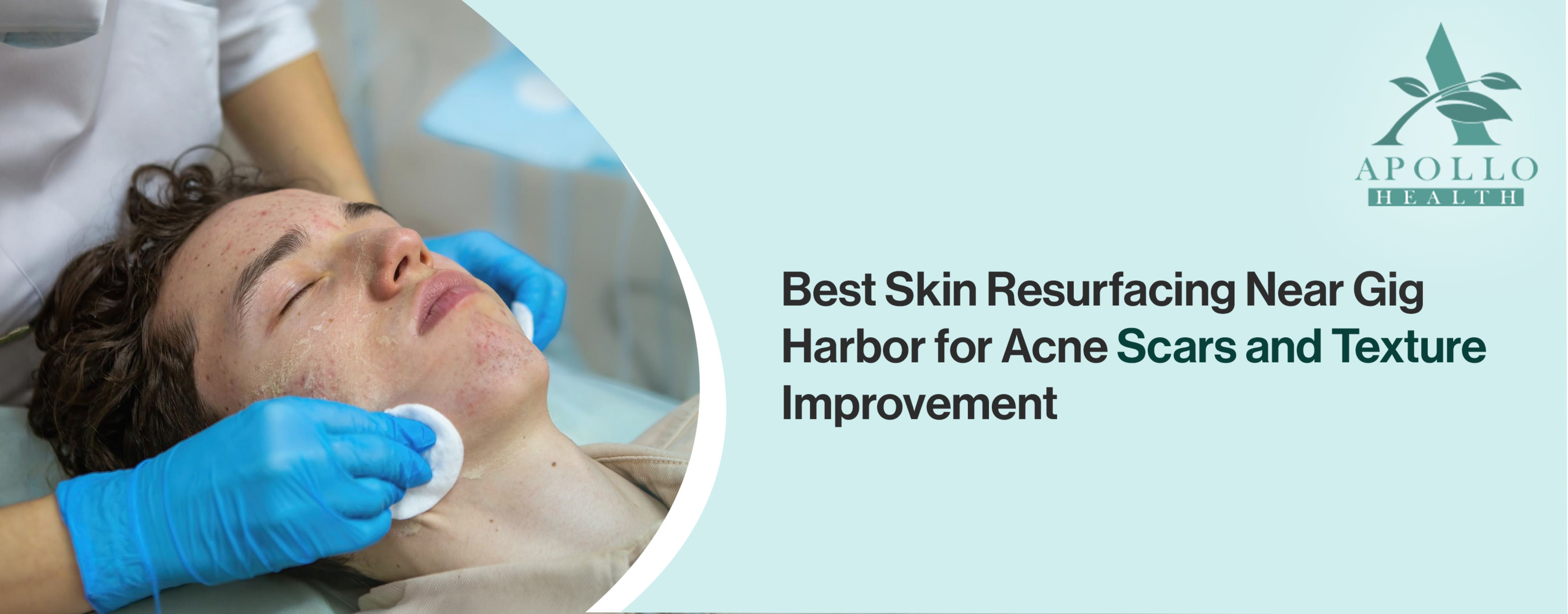Best Skin Resurfacing Near Gig Harbor