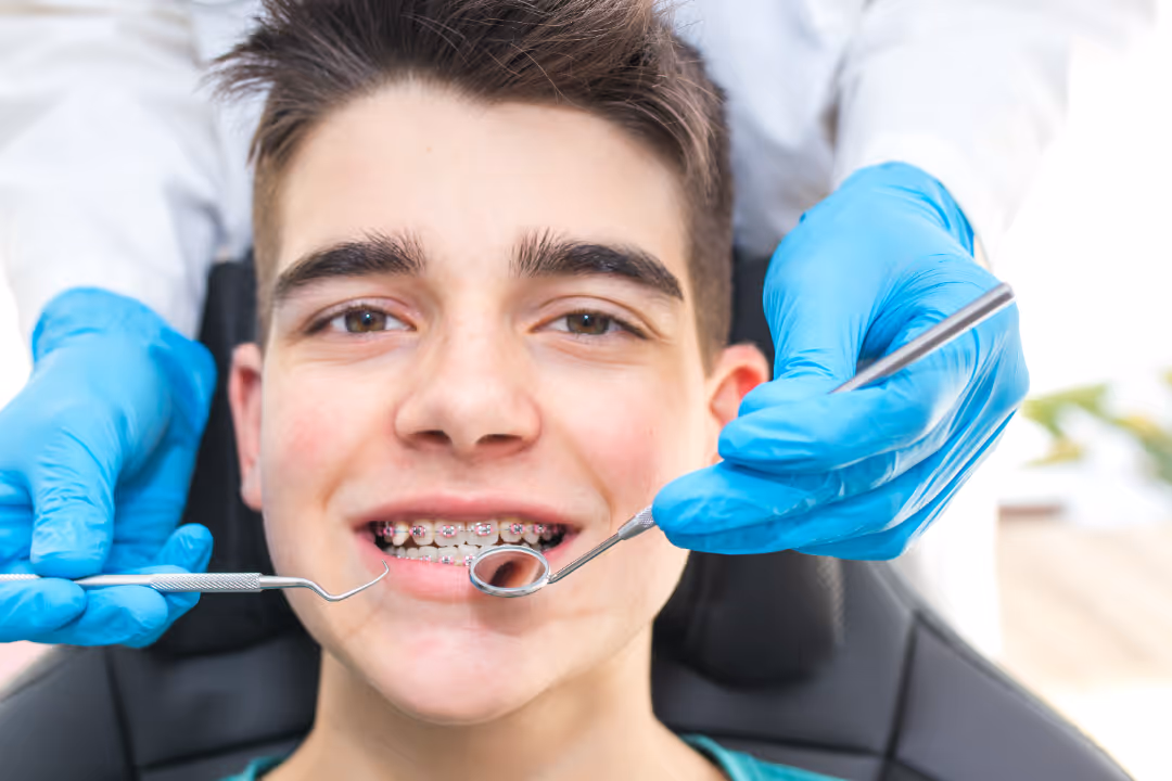 C5 Hidden Orthodontics: A Faster, More Discreet Way to Straighten Teeth