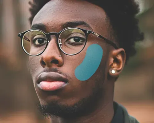 Use the blemish photo editor to edit your pictures