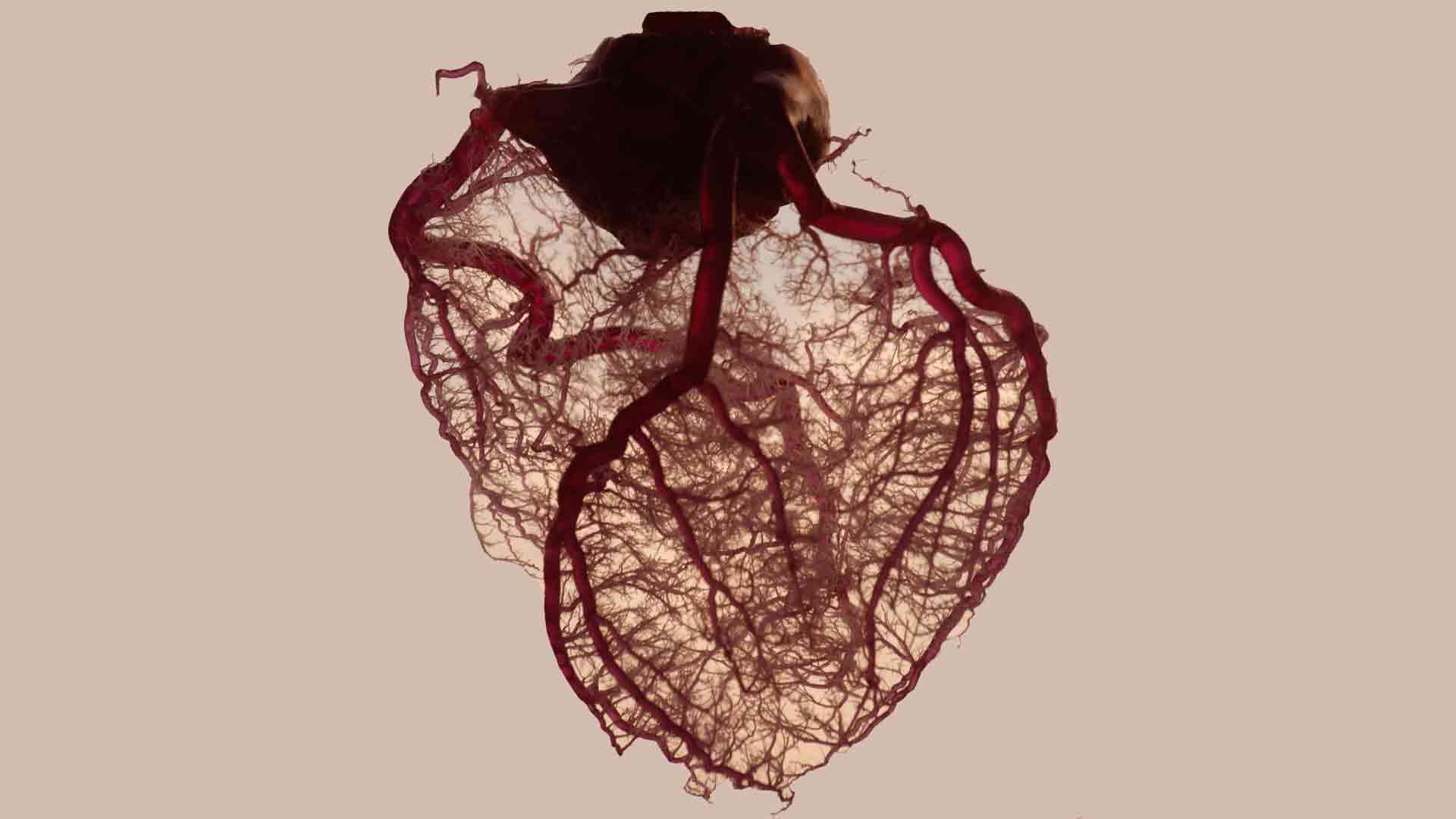 This is the vasculature of an actual heart (porcine heart, identical to human heart).