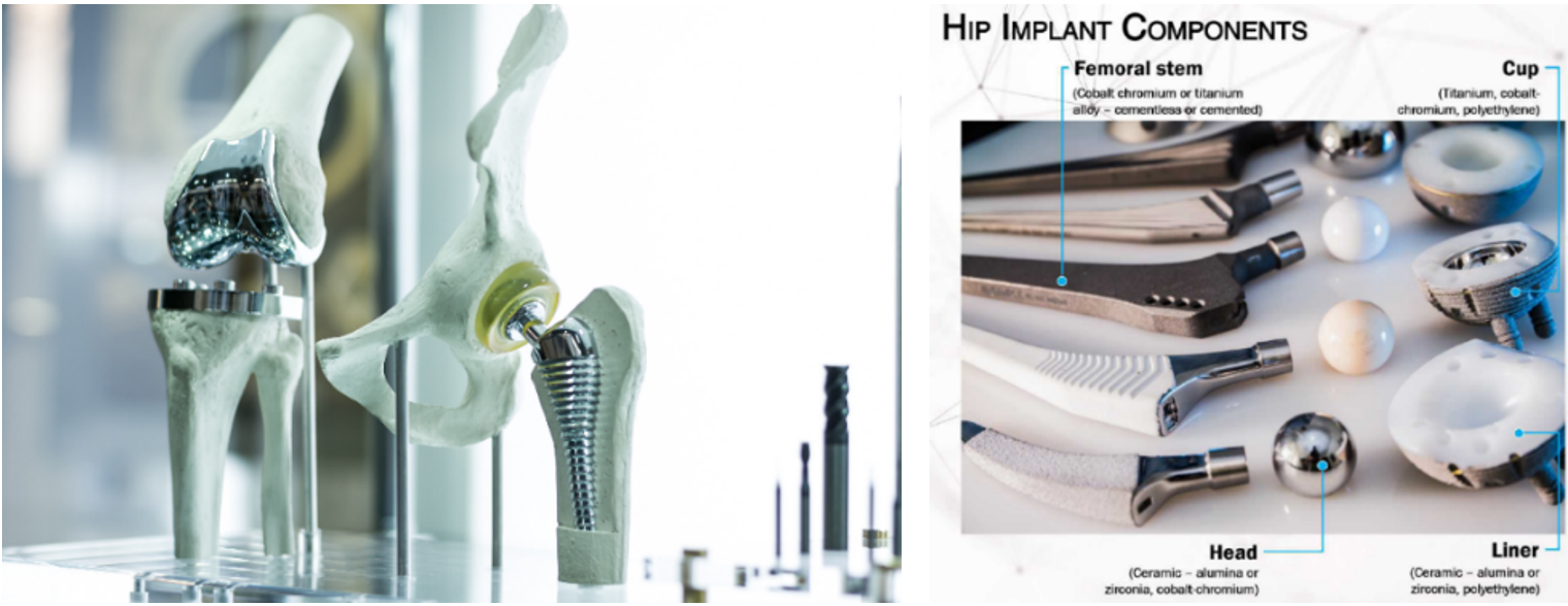Implants