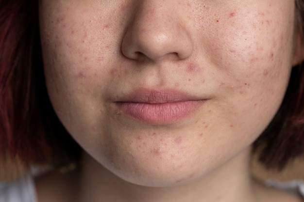 Free photo close up on skin pores during face care routine