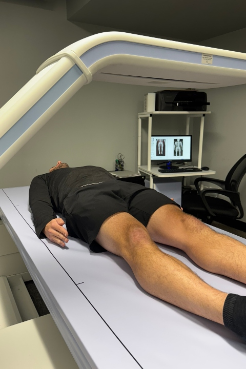 DEXA Scan