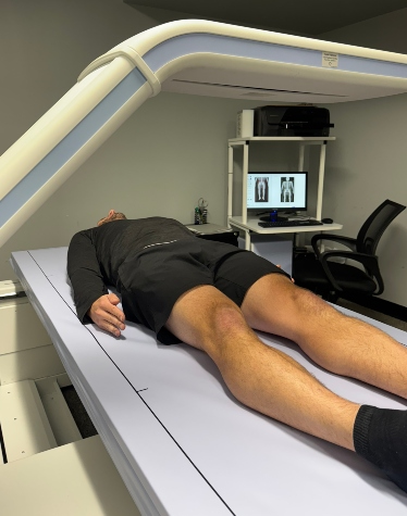 DEXA Scan