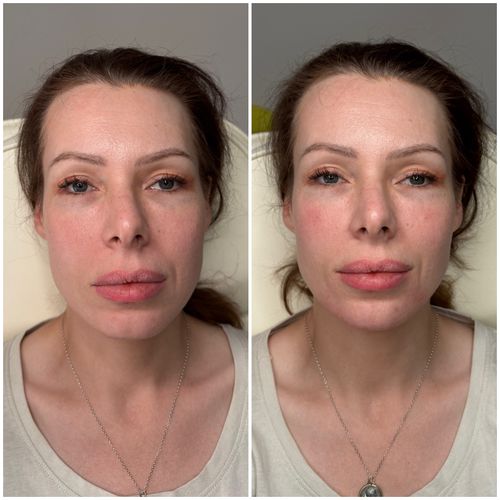 The Oriah Approach: My Philosophy on Holistic, Tailored Facial Rejuvenation