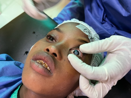 Child with traumatic cataract