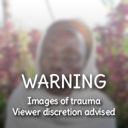 Image of Anya Basa with warning. Images of trauma.