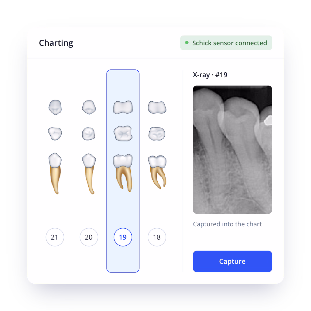 Archy dental xray software displaying tooth #19 selected on a graphical chart with its corresponding radiograph.