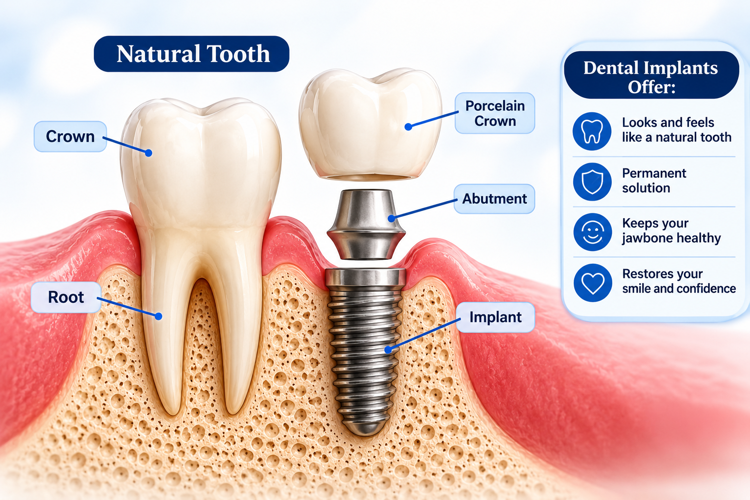 Smile Today in Yukon offers dental implants to restore your smile!