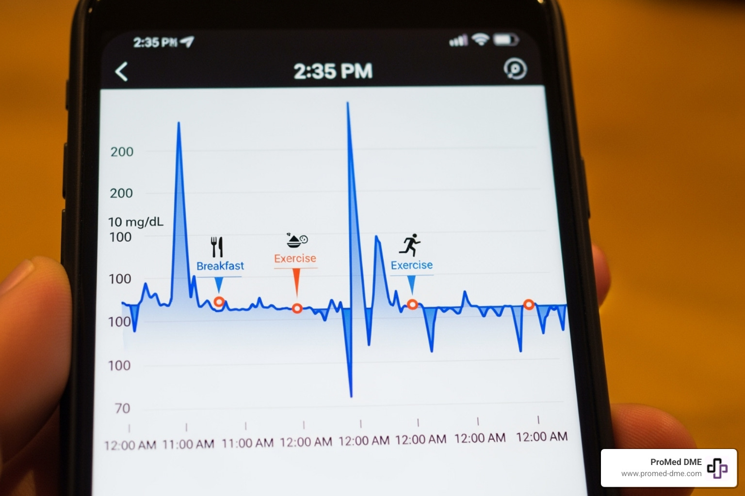 CGM data graph on a smartphone showing glucose trends over 24 hours - blood glucose monitoring system
