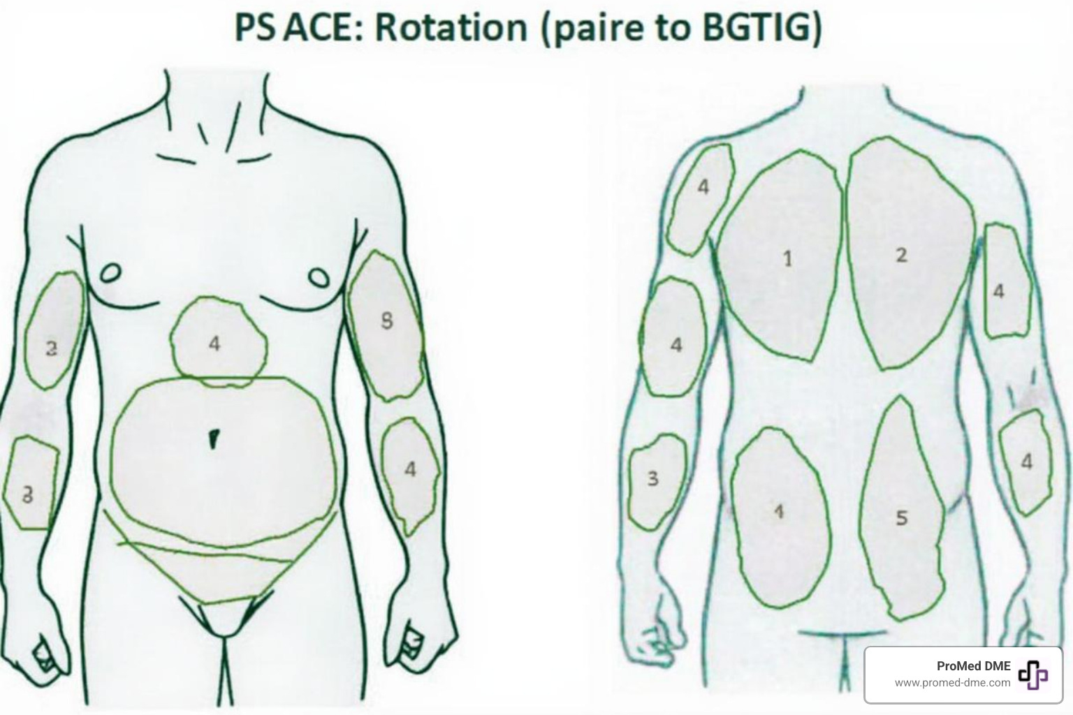 Image of a site rotation chart for the abdomen and arms - Insulin pump skin irritation