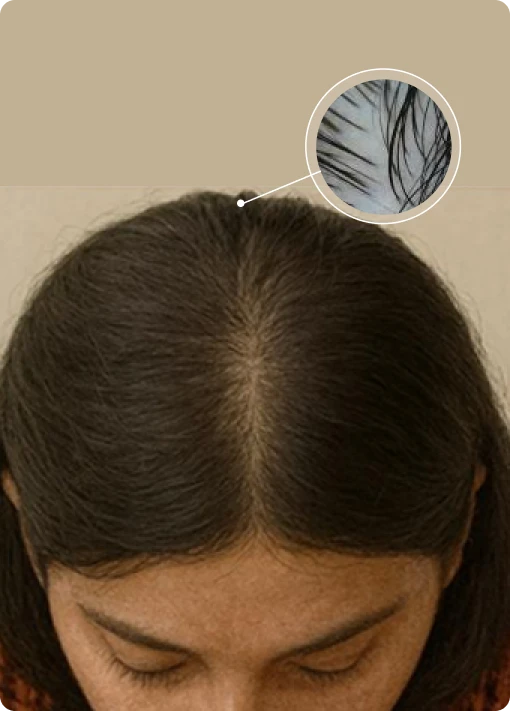 Scalp image