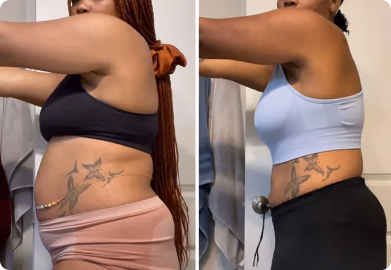 Before and after - Linda