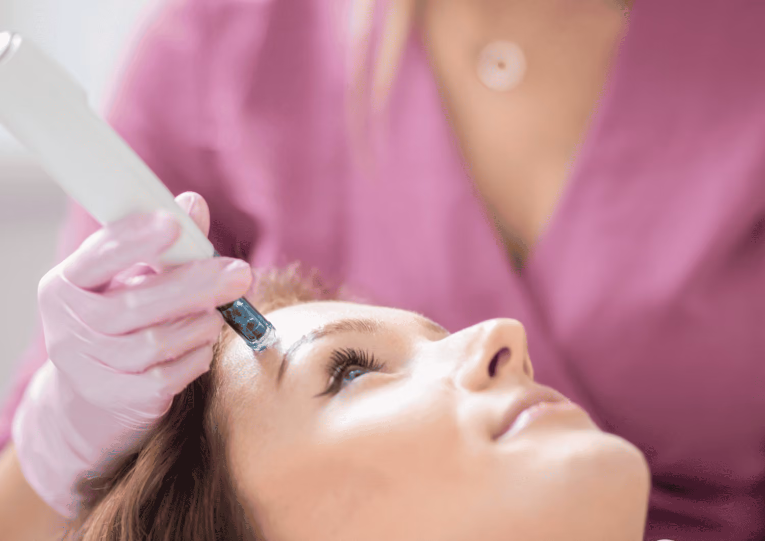 Mikrojehličkování (microneedling)