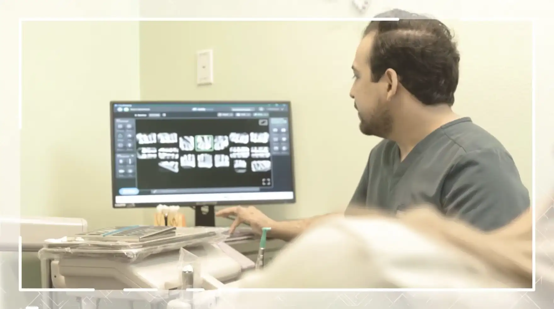 Teeth Whitening video