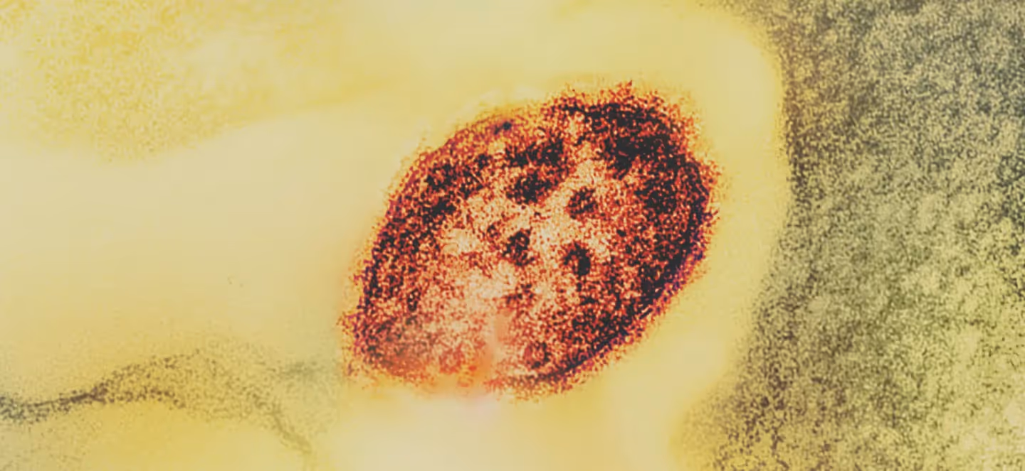 close‑up microscopic view of a virus particle with textured red and yellow coloration