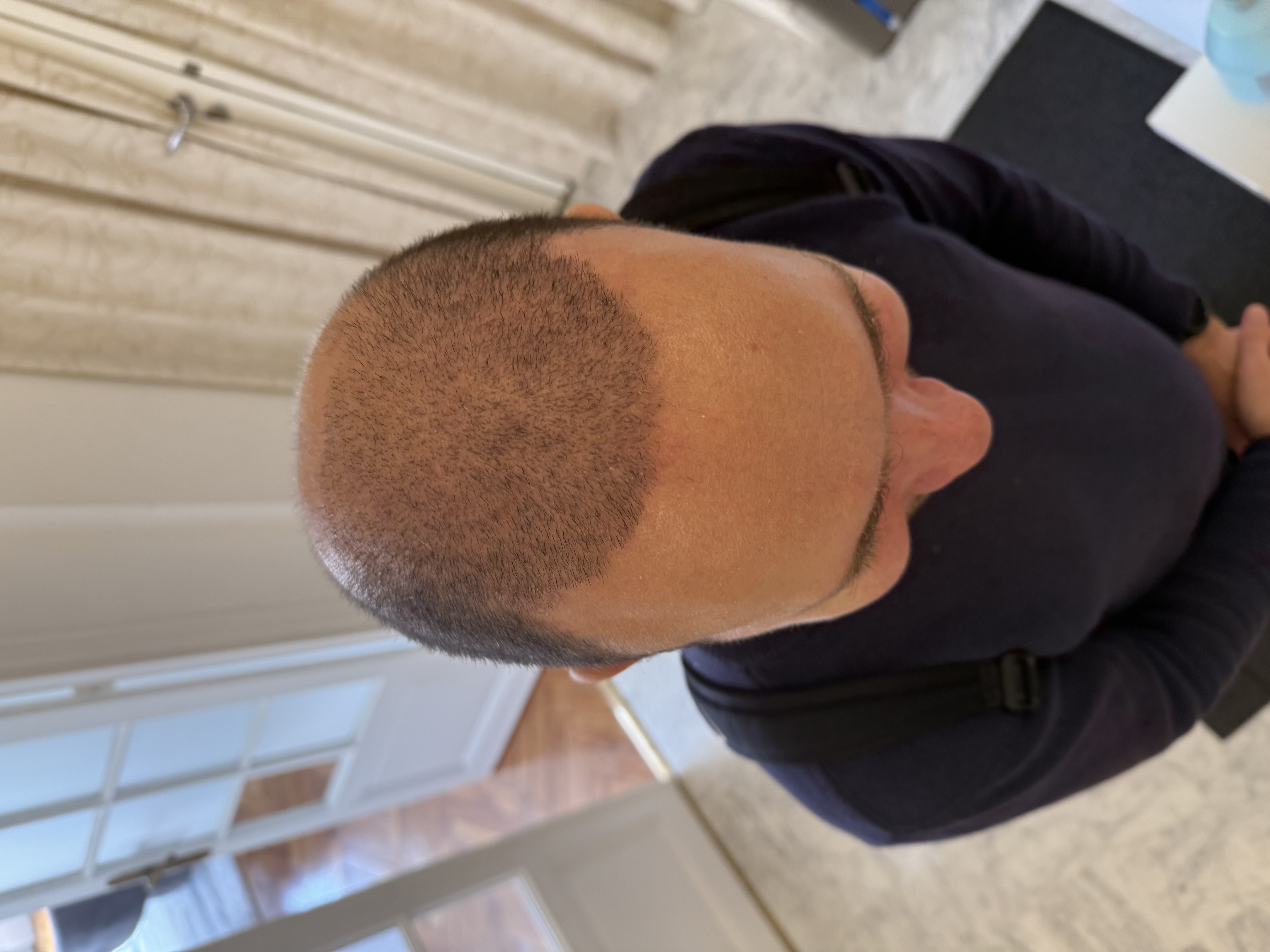 Pourquoi la phase de “chute de choc” est une étape normale ?