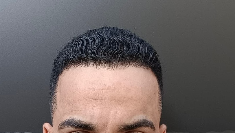 Pourquoi la ligne frontale est l’élément le plus important du résultat ?