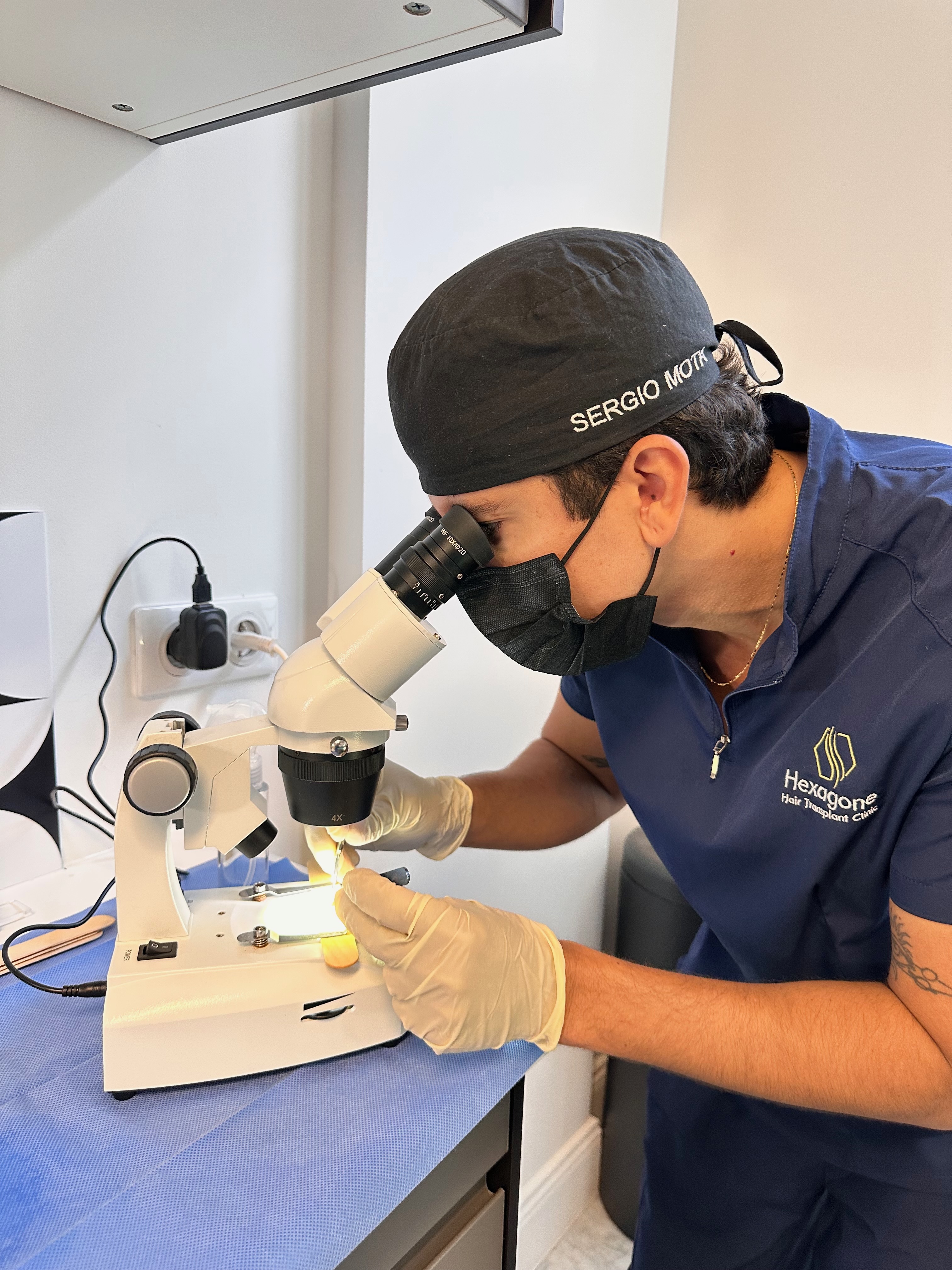 Greffe capillaire Nice vs Turquie : ce que personne ne vous dit