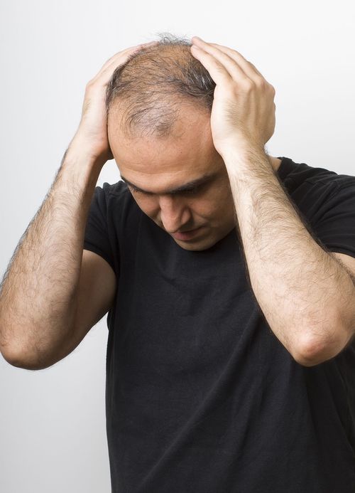 Traitement de la chute de cheveux : Pourquoi il ne faut pas attendre avant d’agir ?