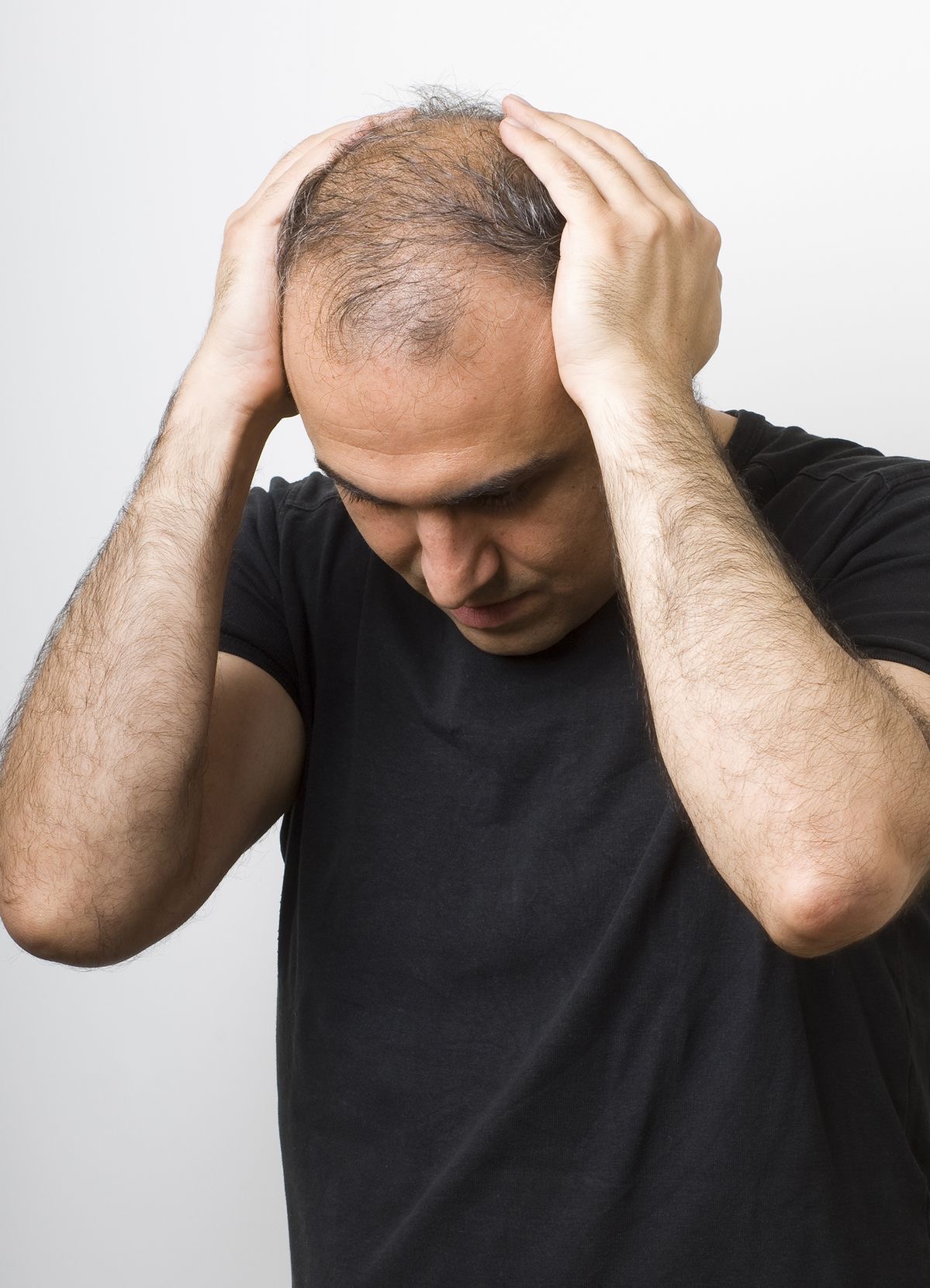 Hair Loss Treatment: Why You Shouldn't Wait to Act