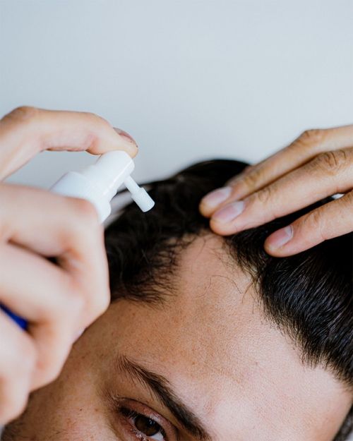 Why are some forms of hair loss not candidates for a hair transplant?