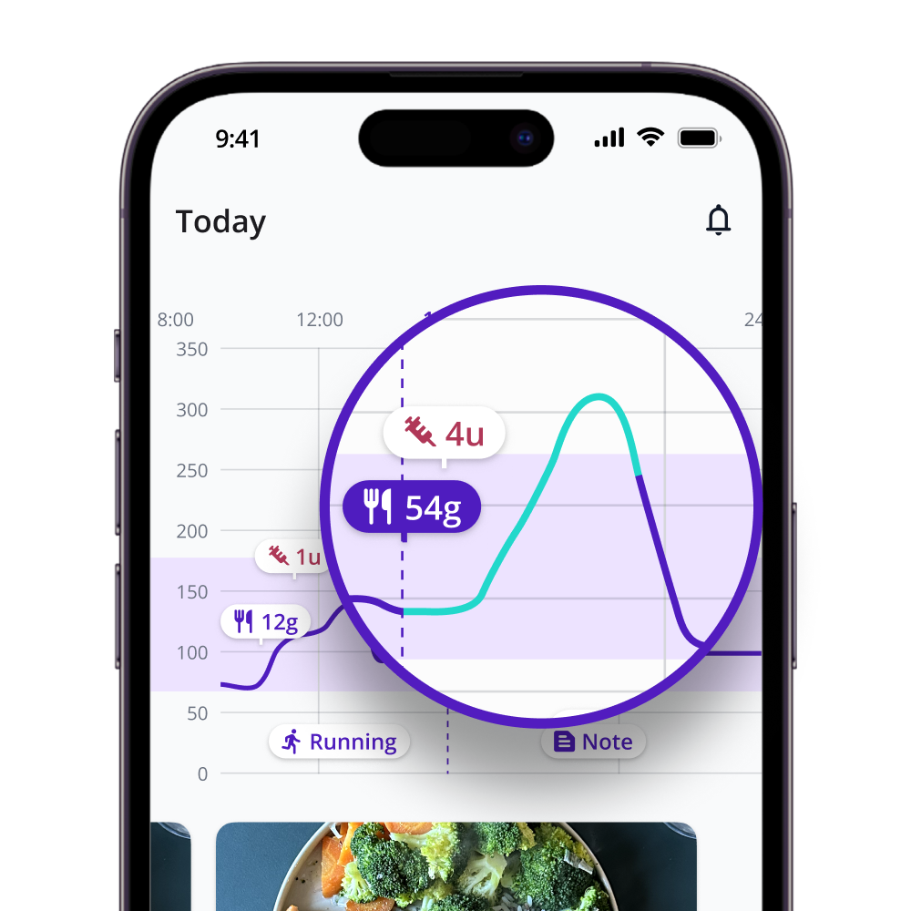 Charts shows Glucose data from CGM after meal