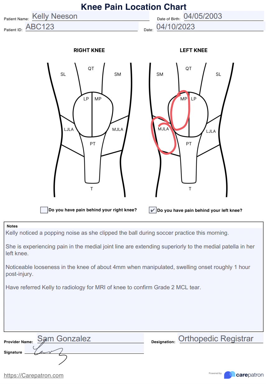 Knee Pain Location Chart example (sample)