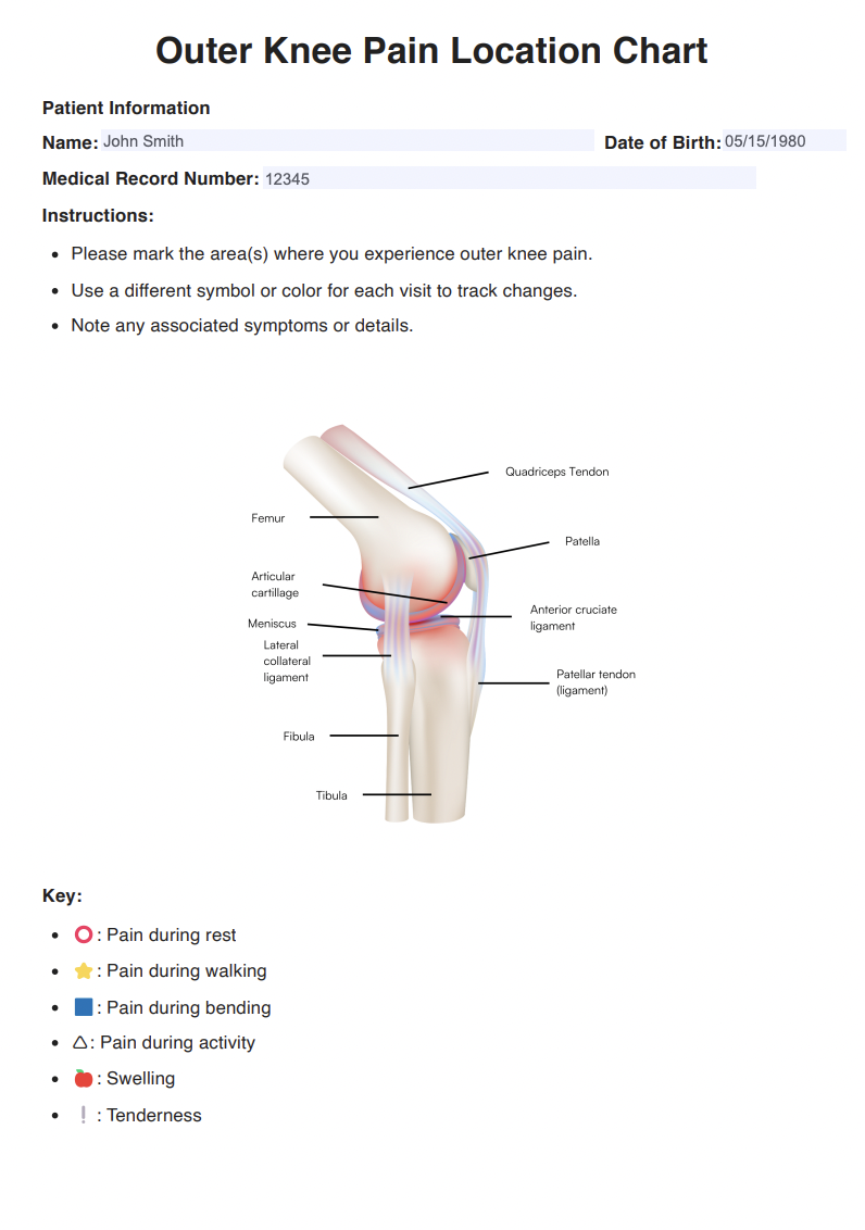 Outer Knee Pain Location Charts Example (sample)