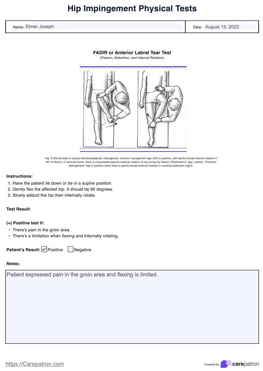 Hip Impingement example (sample)