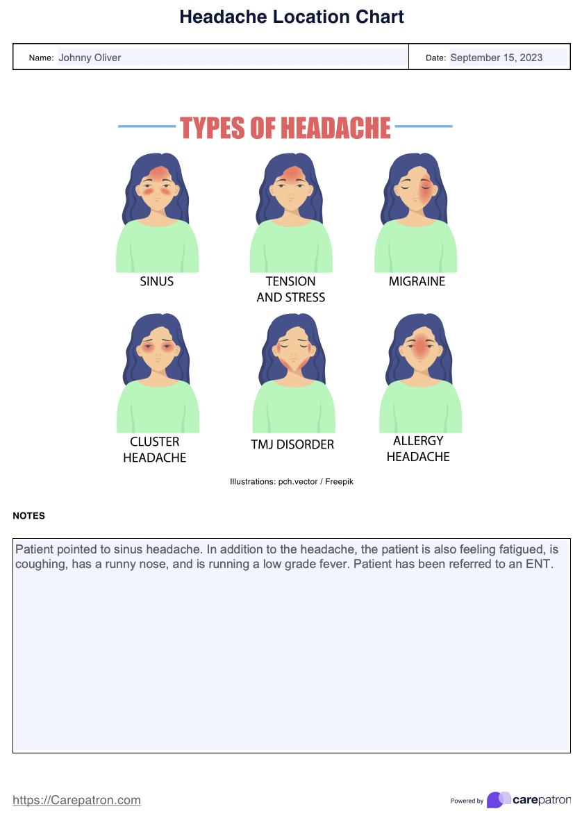 Headache Location Charts Example (sample)