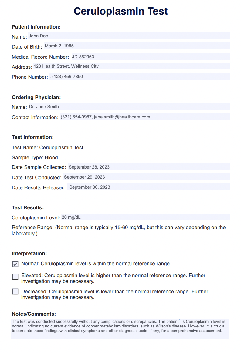 Ceruloplasmin Test Example (Sample)
