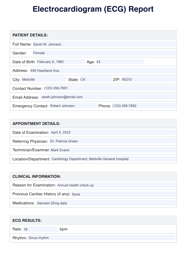 Electrocardiogram Test Example (sample)