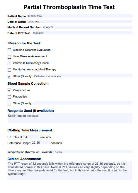 Partial Thromboplastin Time Test Example (sample)