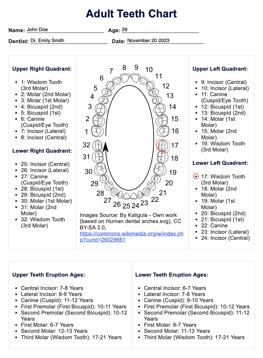 Adult Teeth Chart Example (Sample)