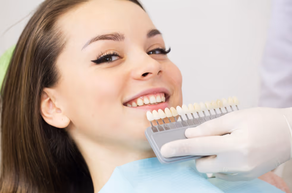 How Long Do Porcelain Veneers Last and What Is the Process?