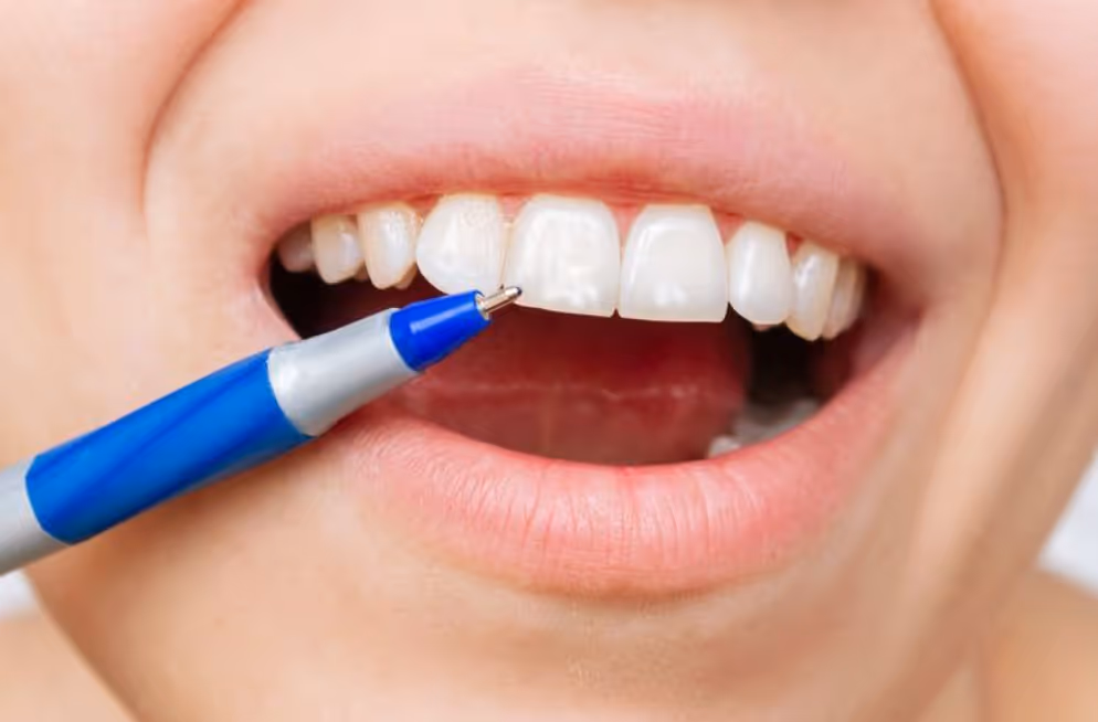 Which Foods and Drinks Cause the Most Damage to Tooth Enamel?